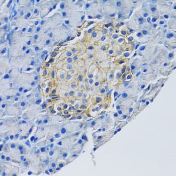 SLC1A2 / EAAT2 / GLT-1 Antibody (aa495-574)