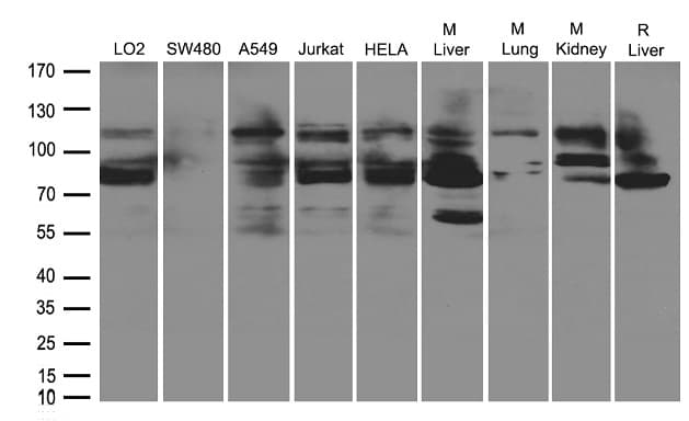 Polyclonal Rabbit anti-Human GLCNE / GNE Antibody (WB)