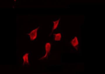Polyclonal Rabbit anti-Human PRKY Antibody (IF, WB)