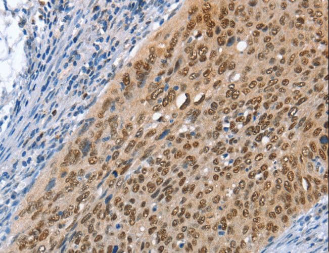Polyclonal Rabbit anti-Human MCM6 Antibody (IHC, WB)