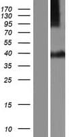 STX16 / Syntaxin 16 Protein (Over-Expression Lysate Myc-DDK (Flag))