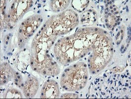 Monoclonal Mouse anti-Human RARRES1 Antibody (clone OTI1B1, IHC, WB)