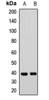 KHDRBS3 / SLM2 Antibody