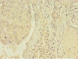 NR1A2 / THRB Antibody (aa1-461)