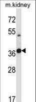 Polyclonal Rabbit anti-Mouse TSSK6 Antibody (aa204-232, WB)