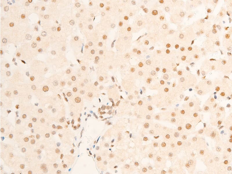 Polyclonal Rabbit anti-Human TK1 / TK / Thymidine Kinase Antibody (phospho-Ser13, IHC, IF, WB)