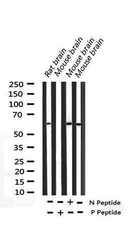 Polyclonal Rabbit anti-Human ELK1 Antibody (phospho-Ser389, IHC, IF, WB)