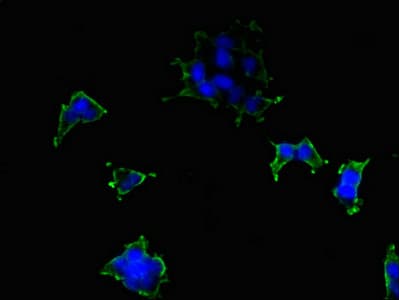 ATP2B2 / PMCA2 Antibody
