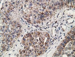 SSX1 Antibody (clone OTI1E10)