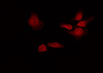 Polyclonal Rabbit anti-Human PSEN1 / Presenilin 1 Antibody (IHC, IF, WB)