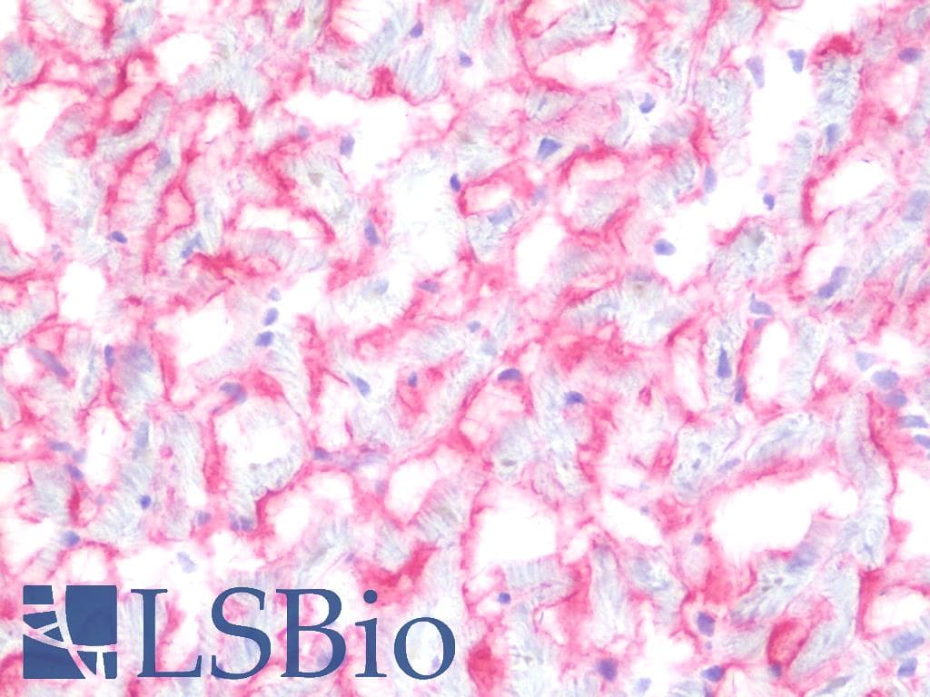 IHC-plus™ SGCB / SGC / Sarcoglycan Beta Antibody (clone 1E3)