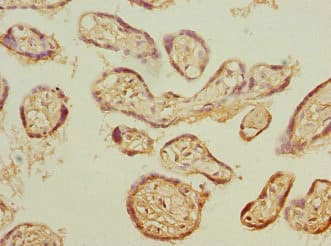 Polyclonal Rabbit anti-Human PSMB3 Antibody (IHC, WB)