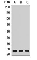 Polyclonal Rabbit anti-Human ATP6E / ATP6V1E1 Antibody (WB)