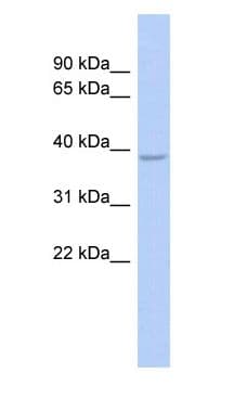 Polyclonal Rabbit anti-Human SOX7 Antibody (C-Terminus, WB)
