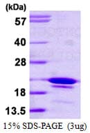 Human SYF2 / p29 Protein (Recombinant His)
