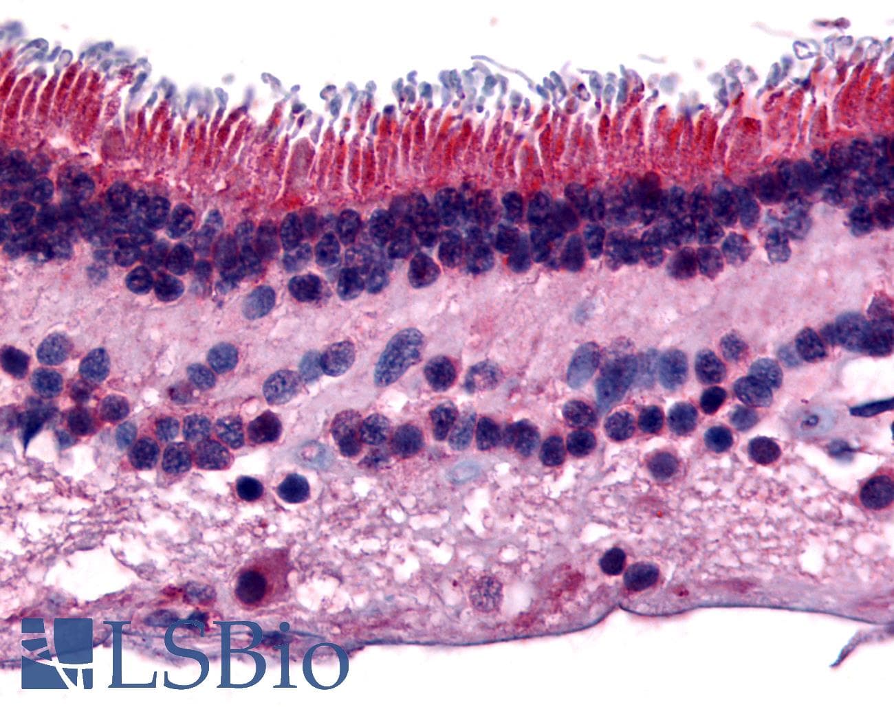 IHC-plus™ PTPRM / PTP Mu Antibody (Internal)