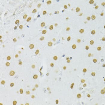 BRCA1 Antibody