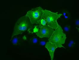 Monoclonal Mouse anti-Human CD5 Antibody (clone OTI2B8, IF, WB)