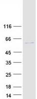 Human CHKA / CK / Choline Kinase Protein (Recombinant Myc-DDK (Flag))