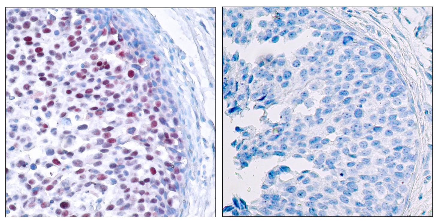JUN / c-Jun Antibody (phospho-Thr239)