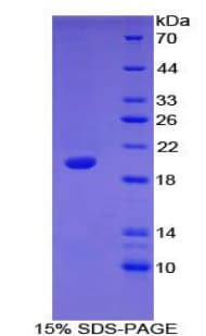 Mouse NUP210 / gp210 Protein (Recombinant His-T7)