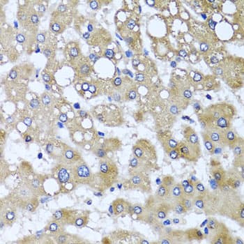 KIAA0153 / TTLL12 Antibody