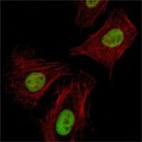 Monoclonal Mouse anti-Human RCHY1 / PIRH2 Antibody (clone 1H10, IHC, IF, WB)