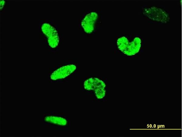 IHC-plus™ ARID3A / DRIL1 Antibody (clone 1A11)