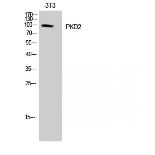 PRKD2 / PKD2 Antibody (810-890 aa)