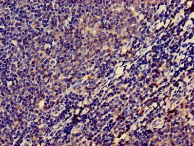 Polyclonal Rabbit anti-Human LPXN / Leupaxin Antibody
