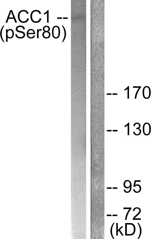 Acetyl-CoA Carboxylase / ACC Antibody (phospho-Ser80)