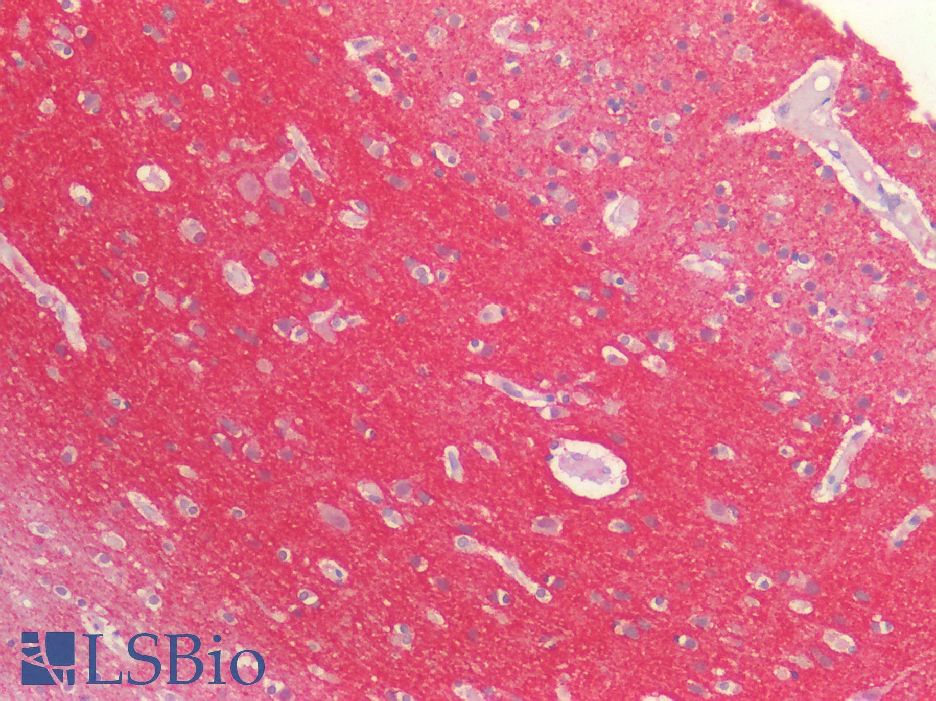 PathPlus™ SNCA / Alpha-Synuclein Antibody