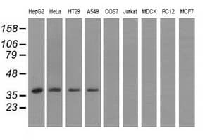 HIBCH Antibody (clone OTI3B10)