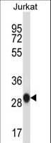 Polyclonal Rabbit anti-Human PHAP1 / ANP32A Antibody (aa133-162, IHC, WB)