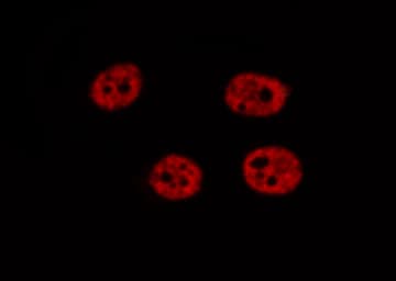 Polyclonal Rabbit anti-Human FOXR1 Antibody (IHC, IF, WB)