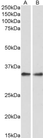 IHC-plus™ PPP4C Antibody (aa290-301)