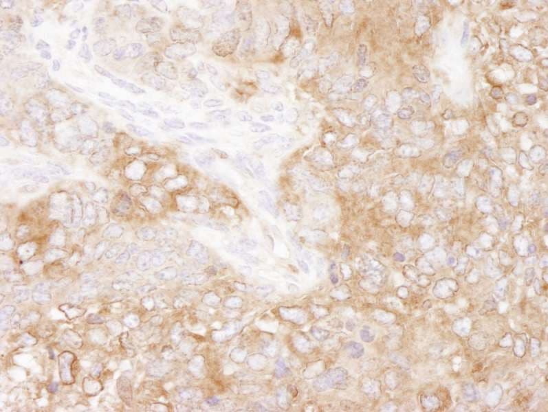 EEF2 / Elongation Factor 2 Antibody (aa808-858)