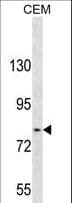 Polyclonal Rabbit anti-Human TGFBRAP1 / TRAP-1 Antibody (aa499-528, IHC, WB)