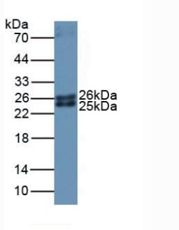 FTMT / MTF Antibody (aa54-229, PE)