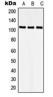 STK9 / CDKL5 Antibody (N-Terminus)