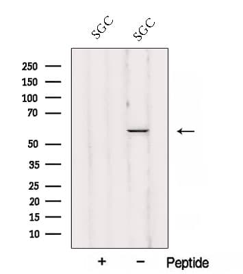 Polyclonal Rabbit anti-Human JUB / Ajuba Antibody (WB)