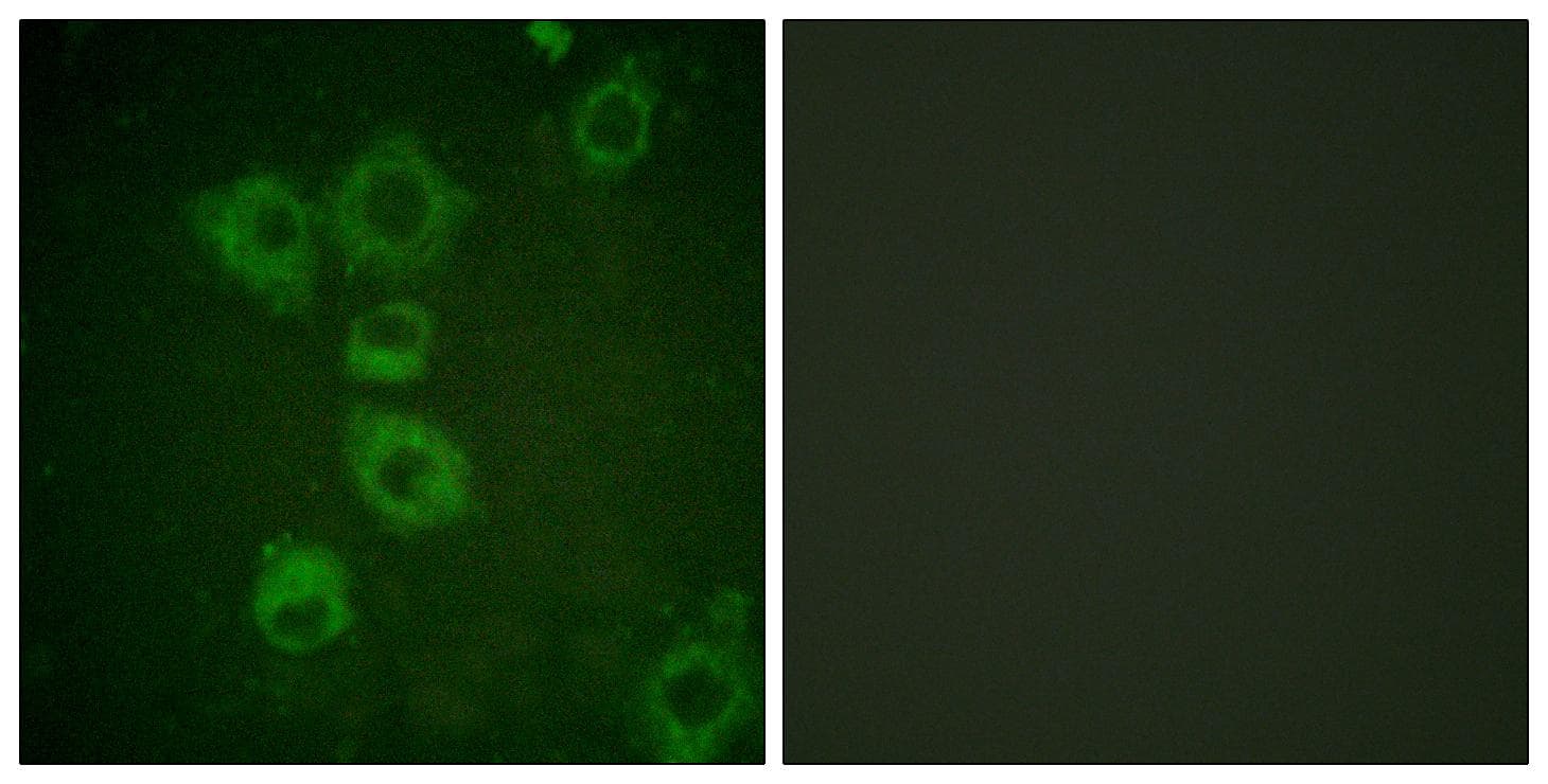CASP6 / Caspase 6 Antibody (p257)