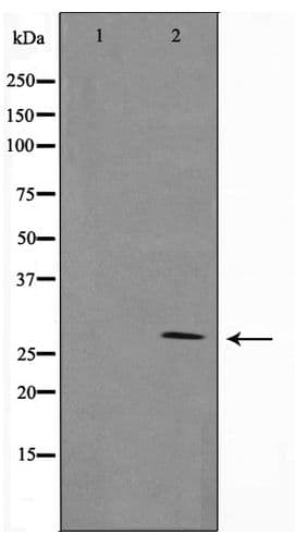 Polyclonal Rabbit anti-Human 14-3-3 Beta + Zeta Antibody (WB)