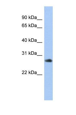 ZNF763 Antibody (C-Terminus)