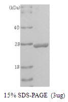 Human UCHL1 / PGP9.5 Protein (Recombinant)