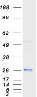 Human RAB8A / RAB8 Protein (Recombinant Myc-DDK (Flag))