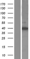 ZC3H12D Protein (Over-Expression Lysate Myc-DDK (Flag))