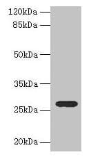 Polyclonal Rabbit anti-Human TEX35 / C1orf49 Antibody (IHC, WB)