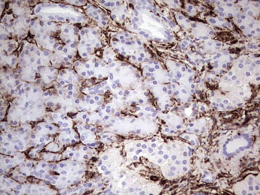 Monoclonal Mouse anti-Human Vimentin Antibody (clone UMAB159, Carrier-free, aa210-466, IHC, IF, WB)