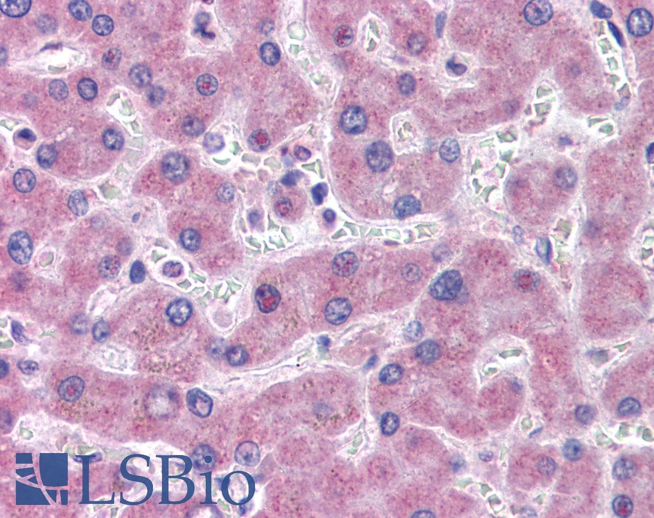 IHC-plus™ GFPT1 / GFAT Antibody (N-Terminus)